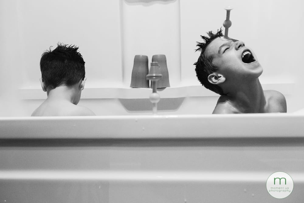 boy with toy stuck to forehead